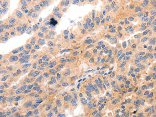 MYL9 Polyclonal Antibody Store at -20°C