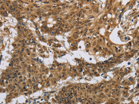 IL5RA Polyclonal Antibody Store at -20°C