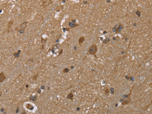 GALK1 Polyclonal Antibody