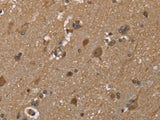 GALK1 Polyclonal Antibody