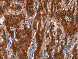 GCKR Polyclonal Antibody Host Rabbit