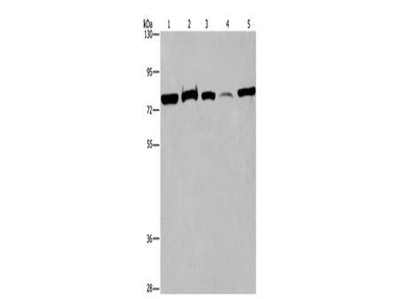 ACVR2A Polyclonal Antibody Reactivity Human