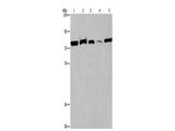 ACVR2A Polyclonal Antibody Reactivity Human