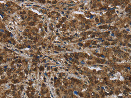 PIP Polyclonal Antibody Store at -20°C