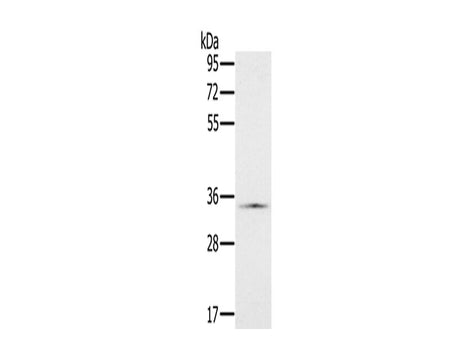 NDUFA9 Polyclonal Antibody Store at -20°C