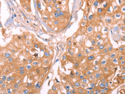 GC Polyclonal Antibody Store at -20°C