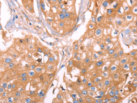 GC Polyclonal Antibody Store at -20°C