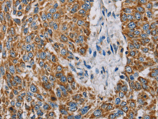 MTFP1 Polyclonal Antibody Store at -20°C