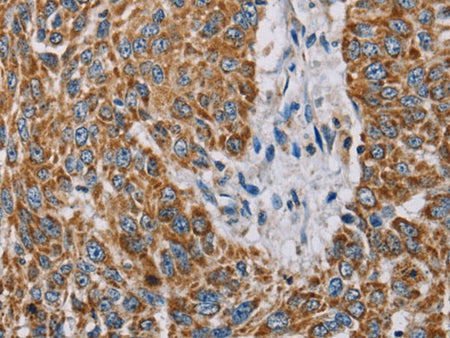 MTFP1 Polyclonal Antibody Store at -20°C