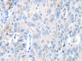MAGEB4 Polyclonal Antibody