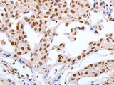 Oct-6 Polyclonal Antibody