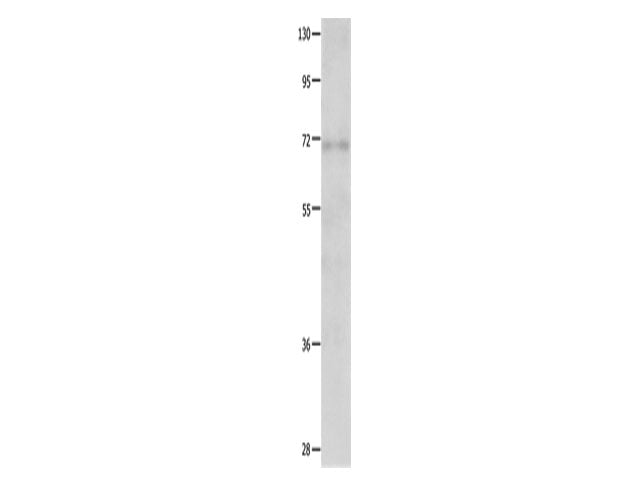 IGF2BP1 Polyclonal Antibody Store at -20°C