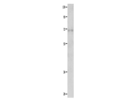 IGF2BP1 Polyclonal Antibody Store at -20°C