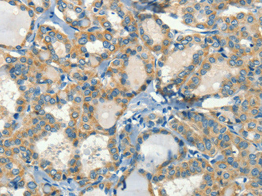 CALCA Polyclonal Antibody Store at -20°C