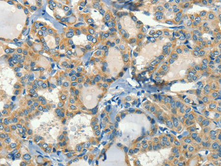 CALCA Polyclonal Antibody Store at -20°C