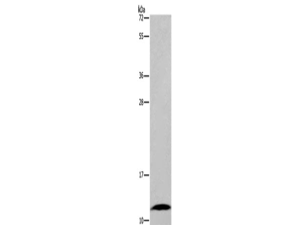 FABP6 Polyclonal Antibody Store at -20°C