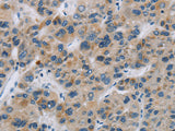 SYN2 Polyclonal Antibody
