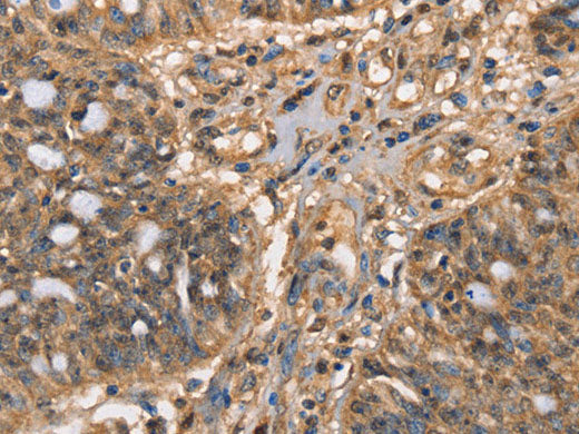 HK3 Polyclonal Antibody Store at -20°C
