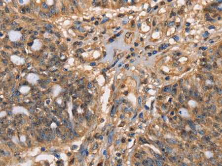 HK3 Polyclonal Antibody Store at -20°C