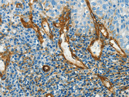 CAV1 Polyclonal Antibody Store at -20°C