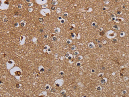 IFRD1 Polyclonal Antibody Store at -20°C