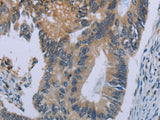 CEBPD Polyclonal Antibody