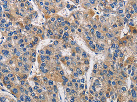 KLK1 Polyclonal Antibody Store at -20°C