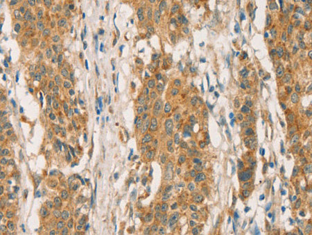 RBBP8 Polyclonal Antibody Store at -20°C