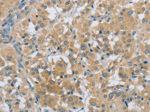 PKD1 Polyclonal Antibody Store at -20°C