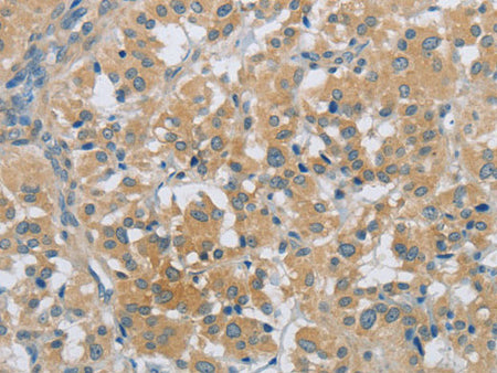 PKD1 Polyclonal Antibody Store at -20°C