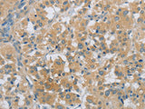 PKD1 Polyclonal Antibody Store at -20°C
