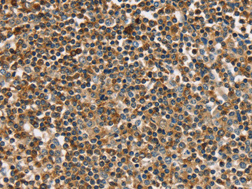 PLS3 Polyclonal Antibody Store at -20°C