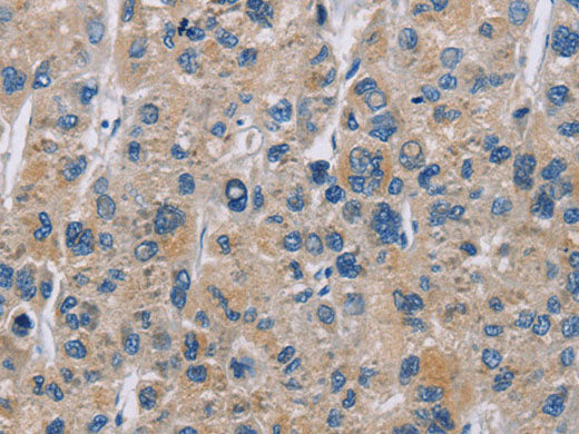 NME5 Polyclonal Antibody