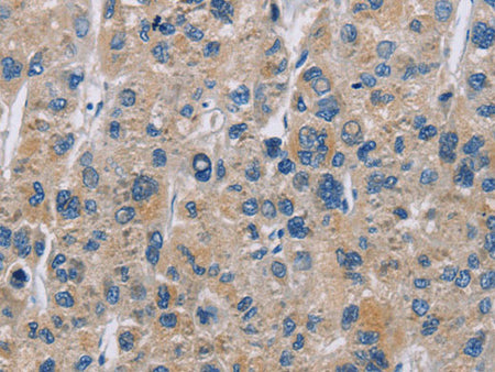 NME5 Polyclonal Antibody