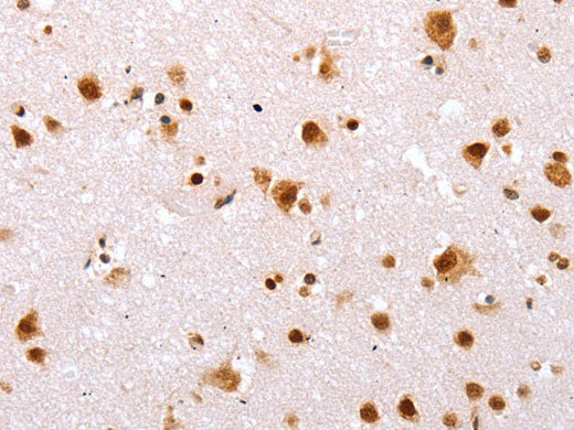 TBX2 Polyclonal Antibody Store at -20°C