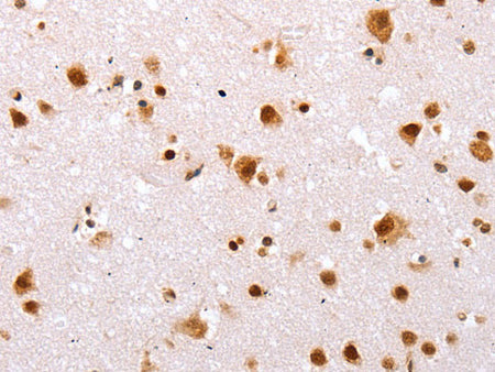 TBX2 Polyclonal Antibody Store at -20°C