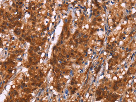BRK1 Polyclonal Antibody Store at -20°C