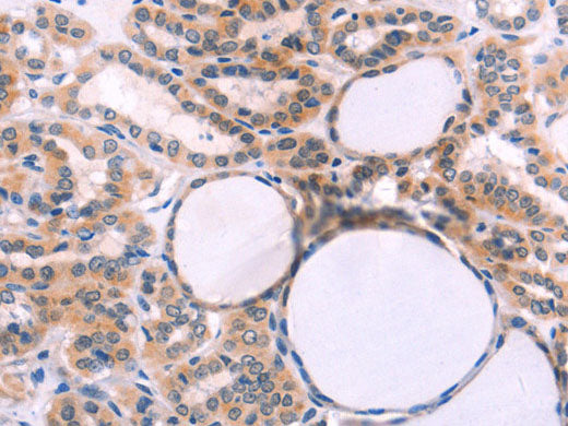 ST2 Polyclonal Antibody Store at -20°C