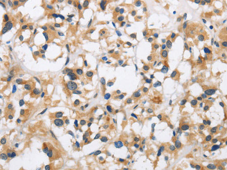 CKMT2 Polyclonal Antibody Store at -20°C