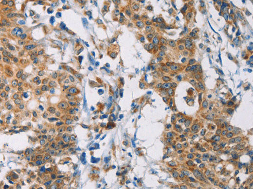 CERK Polyclonal Antibody Store at -20°C