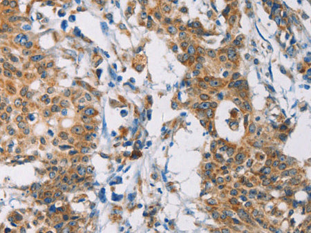 CERK Polyclonal Antibody Store at -20°C