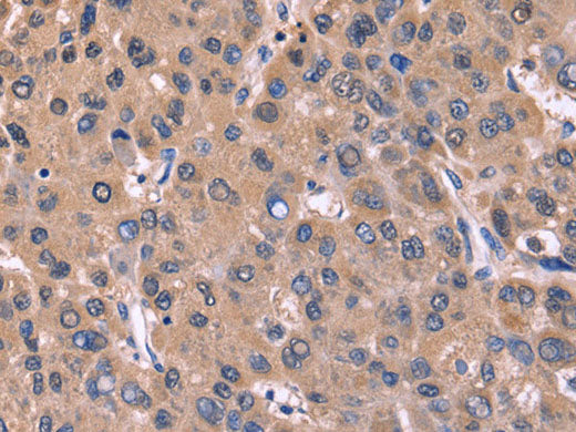 CSNK1D Polyclonal Antibody Store at -20°C