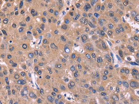 CSNK1D Polyclonal Antibody Store at -20°C