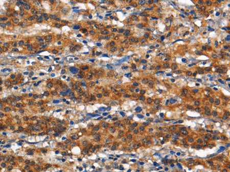 CD13 Polyclonal Antibody Store at -20°C