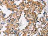 CHMP1A Polyclonal Antibody Store at -20°C
