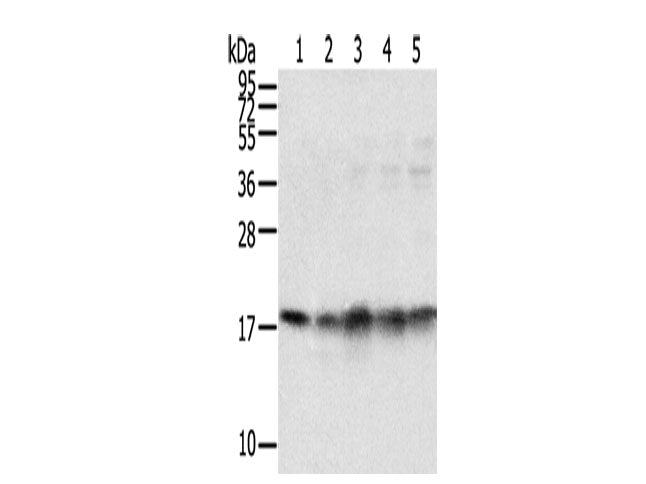 TAF11 Polyclonal Antibody Store at -20°C