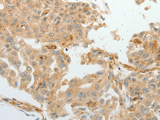 ASCL1 Polyclonal Antibody Store at -20°C