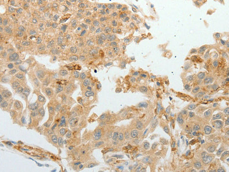 ASCL1 Polyclonal Antibody Store at -20°C