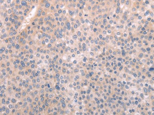 ABCF1 Polyclonal Antibody Store at -20°C