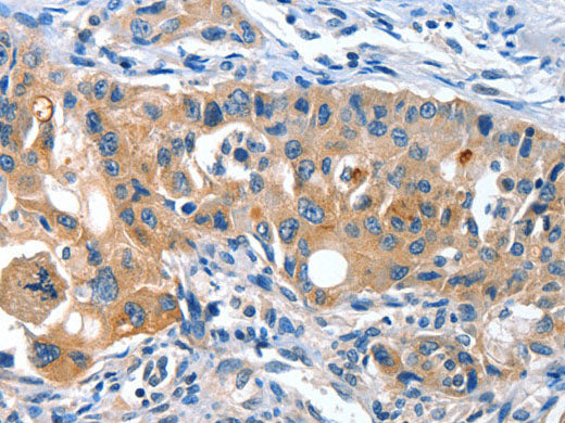 AMHR2 Polyclonal Antibody